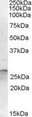 Anti-OTUB2 antibody, Internal used in Western Blot (WB). GTX88682