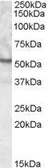 Anti-UNC5CL antibody, Internal used in Western Blot (WB). GTX88695
