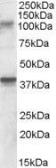 Anti-GRIK3 antibody, Internal used in Western Blot (WB). GTX88696