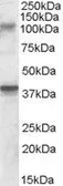 Anti-GRIK3 antibody, Internal used in Western Blot (WB). GTX88696