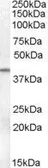 Anti-SERPINB6 antibody, Internal used in Western Blot (WB). GTX88711