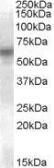 Anti-LYN antibody, Internal used in Western Blot (WB). GTX88717