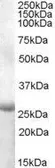 Anti-APOBEC2 (aa180 - 190) antibody, Internal used in Western Blot (WB). GTX88719
