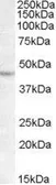 Anti-LHX2 antibody, C-term used in Western Blot (WB). GTX88731