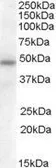 Anti-SERPINA12 antibody, Internal used in Western Blot (WB). GTX88737