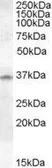 Anti-Cathepsin K antibody, Internal (near N-term) used in Western Blot (WB). GTX88744