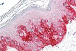 Anti-ATG16L1 antibody, Internal used in IHC (Paraffin sections) (IHC-P). GTX88747