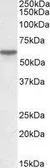 Anti-Vitamin D Binding Protein antibody, Internal used in Western Blot (WB). GTX88762