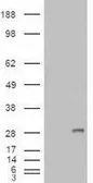 Anti-IGFBP6 antibody, Internal used in Western Blot (WB). GTX88766