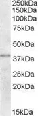 Anti-TXNDC6 antibody, C-term used in Western Blot (WB). GTX88768