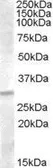 Anti-IGFBP4 antibody, C-term used in Western Blot (WB). GTX88775
