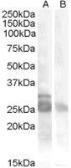 Anti-MYF5 antibody, Internal used in Western Blot (WB). GTX88776