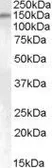 Anti-SENP6 antibody, Internal used in Western Blot (WB). GTX88791