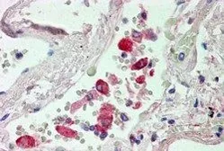 Anti-CES1 antibody, Internal used in IHC (Paraffin sections) (IHC-P). GTX88792