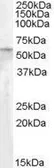 Anti-ATGL antibody, Internal used in Western Blot (WB). GTX88800