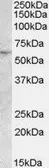 Anti-ATGL antibody, Internal used in Western Blot (WB). GTX88804