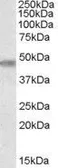 Anti-TOM1L1 antibody, Internal used in Western Blot (WB). GTX88806