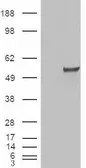 Anti-ERR gamma antibody, Internal used in Western Blot (WB). GTX88809