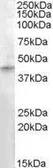 Anti-RASSF8 antibody, Internal used in Western Blot (WB). GTX88813