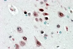 Anti-NOVA1 antibody, Internal used in IHC (Paraffin sections) (IHC-P). GTX88815