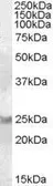 Anti-RAB8A antibody, C-term used in Western Blot (WB). GTX88822