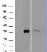 Anti-AKR1B10 antibody, C-term used in Western Blot (WB). GTX88827