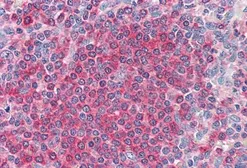 Anti-Frizzled 7 antibody, C-term used in IHC (Paraffin sections) (IHC-P). GTX88831