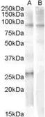 Anti-APOBEC2 (aa12 - 26) antibody, Internal (near the N-term) used in Western Blot (WB). GTX88832