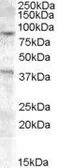 Anti-Exonuclease 1 antibody, Internal used in Western Blot (WB). GTX88837