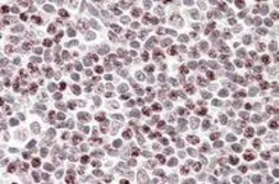 Anti-APOBEC3A antibody, Internal used in IHC (Paraffin sections) (IHC-P). GTX88838
