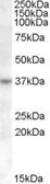 Anti-RASSF7 antibody, Internal used in Western Blot (WB). GTX88839