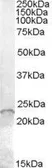 Anti-ASF1A antibody, Internal used in Western Blot (WB). GTX88842