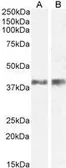 Anti-IL12B / IL12 p40 antibody, Internal used in Western Blot (WB). GTX88847