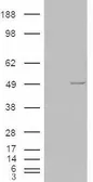 Anti-Casein Kinase 1 epsilon antibody, C-term used in Western Blot (WB). GTX88851