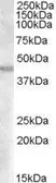 Anti-GOT2 (aa 295 to 306) antibody, Internal used in Western Blot (WB). GTX88853