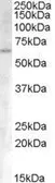 Anti-Activin Receptor Type IA antibody, Internal used in Western Blot (WB). GTX88867