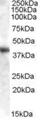 Anti-GOT1 (aa 157-167) antibody, Internal used in Western Blot (WB). GTX88870