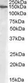 Anti-MAN2A1 antibody, Internal used in Western Blot (WB). GTX88874