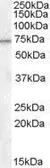 Anti-MEPCE antibody, Internal used in Western Blot (WB). GTX88885