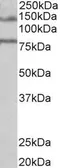 Anti-EBPL41L5 antibody, Internal used in Western Blot (WB). GTX88887