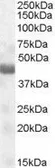 Anti-TUSC4 antibody, Internal used in Western Blot (WB). GTX88896