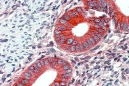 Anti-EPB41L2 (aa 347 to 357) antibody, Internal used in IHC (Paraffin sections) (IHC-P). GTX88899