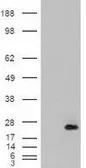 Anti-CSRP2 antibody, Internal used in Western Blot (WB). GTX88912