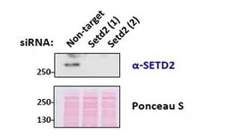 Anti-HYPB/SETD2 antibody, Internal used in Western Blot (WB). GTX88922