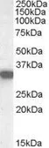 Anti-HADH antibody, Internal used in Western Blot (WB). GTX88923