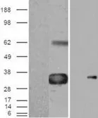 Anti-WISP1 antibody, C-term used in Western Blot (WB). GTX88924