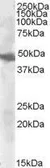 Anti-GOT2 (aa 360 to 373) antibody, Internal used in Western Blot (WB). GTX88925