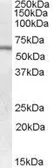 Anti-GALNS antibody, Internal used in Western Blot (WB). GTX88941
