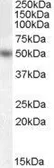 Anti-EGR4 antibody, Internal used in Western Blot (WB). GTX88944