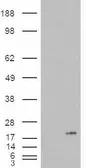 Anti-PLA2G1B antibody, C-term used in Western Blot (WB). GTX88948